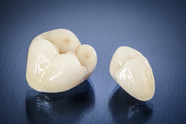 Reasons To Choose A CEREC Dentist For Same Day Crowns